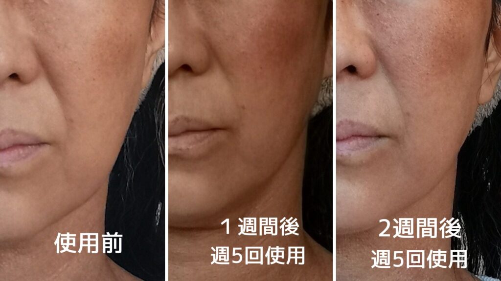 カレントボディLEDマスク ビフォーアフター