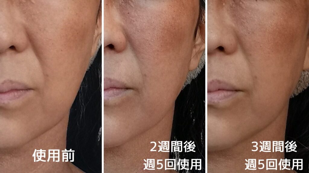 カレントボディLEDマスク ビフォーアフター